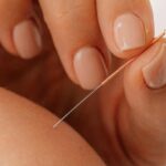 ¿Es normal encontrarse mal después de acupuntura?