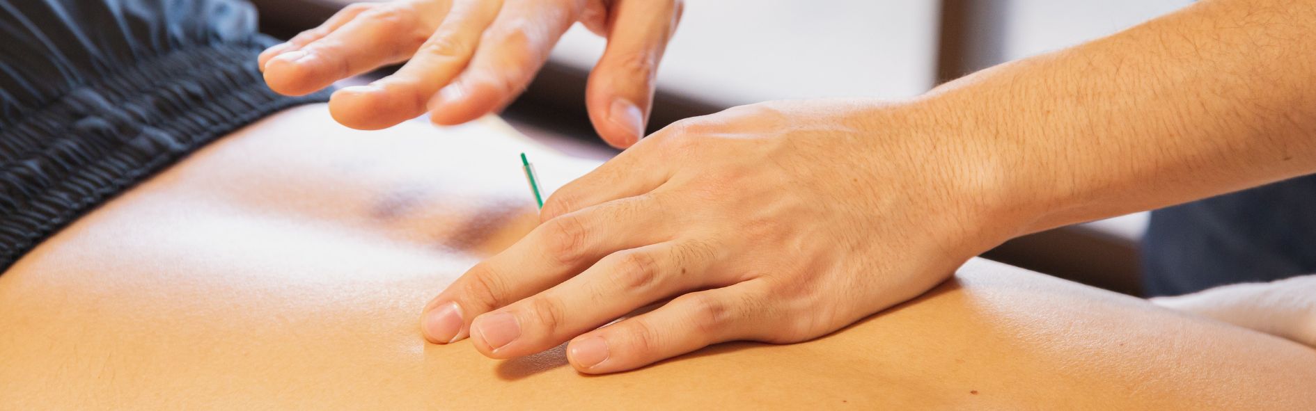 acupuntura: cuando funciona no es por las agujas